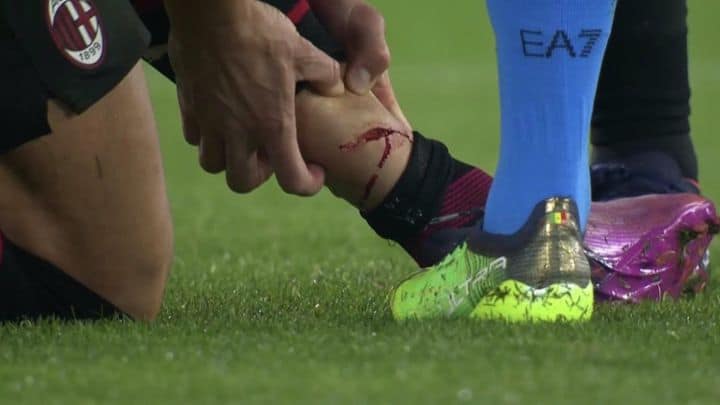 La escalofriante herida de Giroud