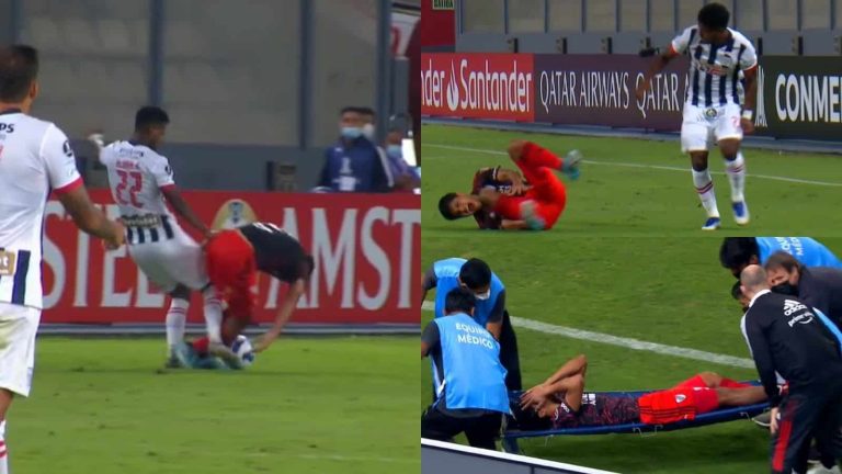 (VIDEO) Durísima imagen en Perú: Robert Rojas sufrió una fractura de tibia y peroné