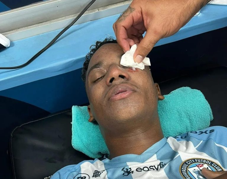 (FOTOS) LUEGO DEL CODAZO DE QUINTERO: Así quedó el ojo de Ramon de Araújo