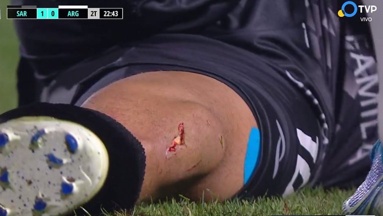 Impactante: El tremendo corte en Sarmiento vs. Argentinos Juniors