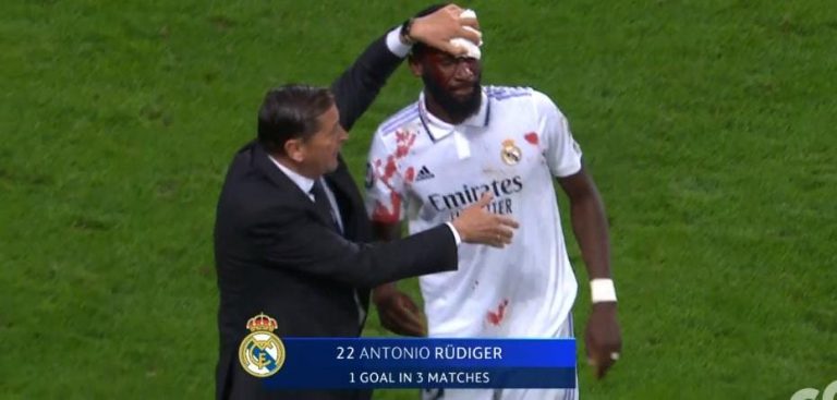 (VIDEO) FUERTES IMÁGENES: Rüdiger quedó herido tras el empate del Madrid
