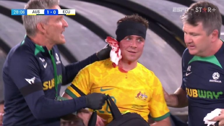 (FOTOS) Lo que sangró Devlin tras chocar con William Pacho