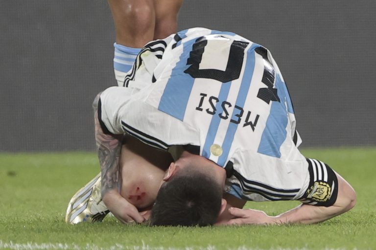 (VIDEO) La impactante imagen de la rodilla de Messi tras un patadón