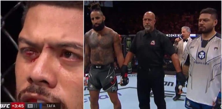 (VIDEO) Suspendieron pelea en UFC porque le estalló el ojo por accidente
