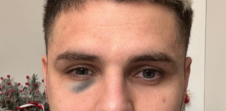 (VIDEO) Icardi acabó el clásico de Turquía retándose con Dzeko y con un ojo morado