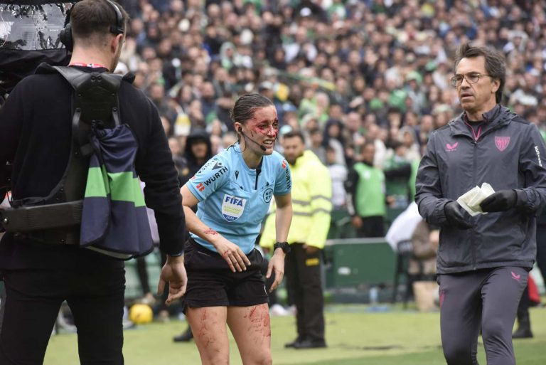 (VIDEO) Árbitra fue retirada en camilla tras un golpe con una cámara de televisión