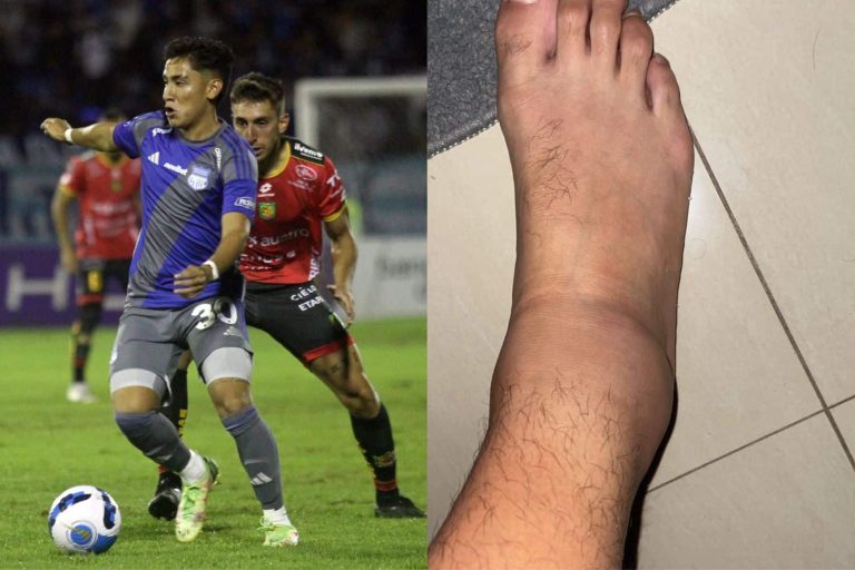 MALAS NOTICIAS EN EMELEC: Tommy Chamba sufrió un esguince en su tobillo