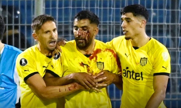 (VIDEO) Imágenes sensibles: Jugador de Peñarol recibió una pedrada en la cara