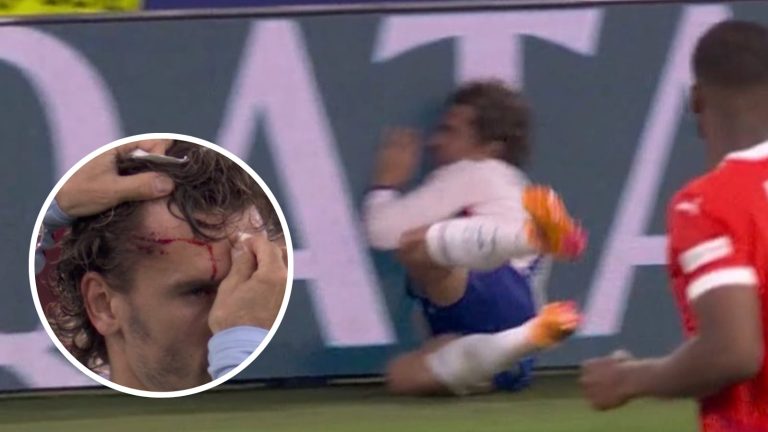 (VIDEO) ¡DURO GOLPE! Griezmann terminó contra los carteles de publicidad