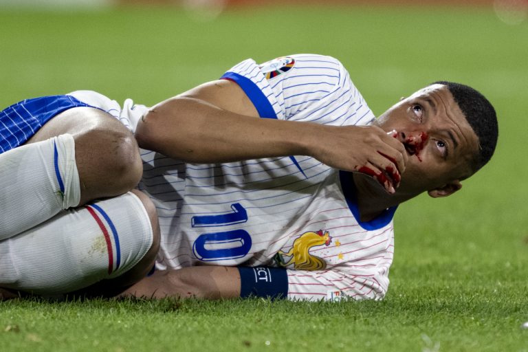 Kylian Mbappé se operará después de la Eurocopa