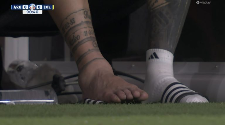 (VIDEO) IMPACTANTE: El tobillo de Messi tras salir lesionado