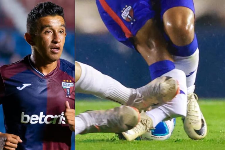 (VIDEO) La escalofriante lesión que sufrió un jugador en el fútbol mexicano