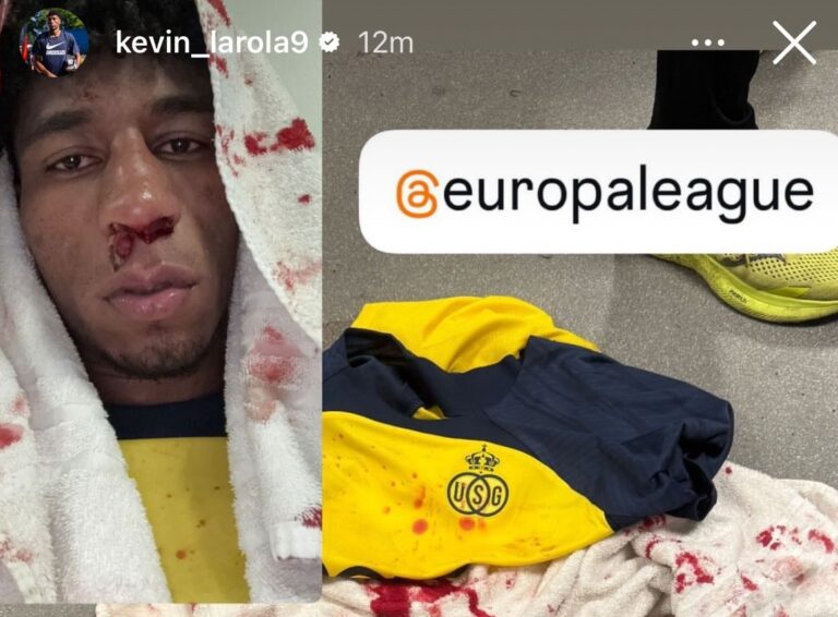 (FOTOS) Así quedó Kevin Rodríguez después del fuerte choque en la Europa League