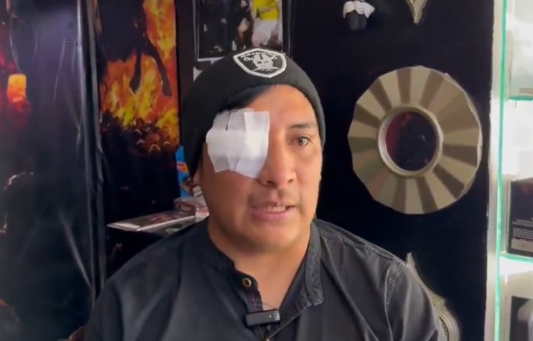 (VIDEO) “Solo pido justicia”: Hincha de LDU que perdió el ojo demandará a los causantes de este hecho