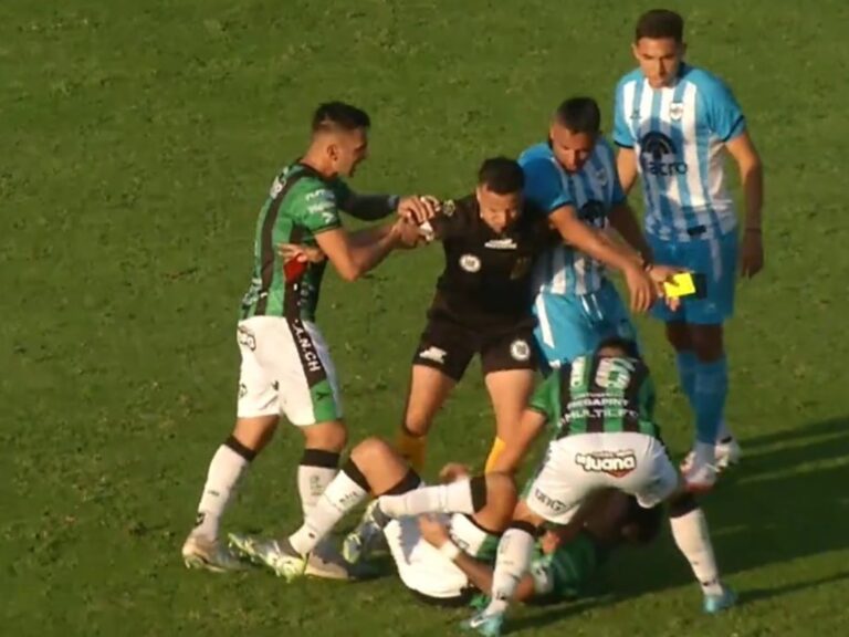 (VIDEO) NO APTO PARA SENSIBLES: Escalofriante lesión que sufrió un futbolista