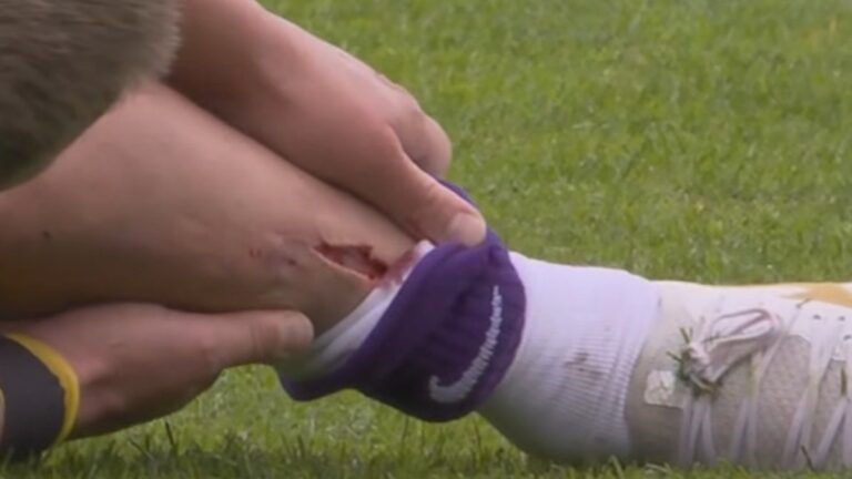 (VIDEO) IMAGENES SENSIBLES: JUgador sufrió un corte que impresionó a todos en el campo