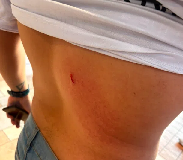 Hincha de Emelec denunció haber sido agredido tras el partido ante Liga de Quito