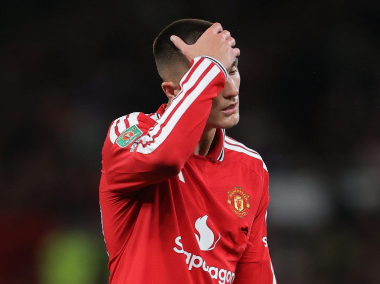 (VIDEO) ELIMINADO: Manchester United cayó ante el Brighton y dijo adiós a la Copa de la Liga